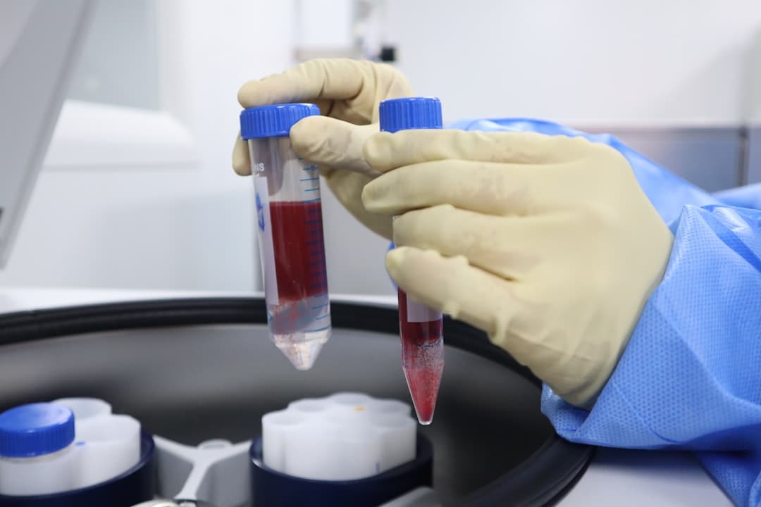 5 Things to Do Before Your Next Blood Test