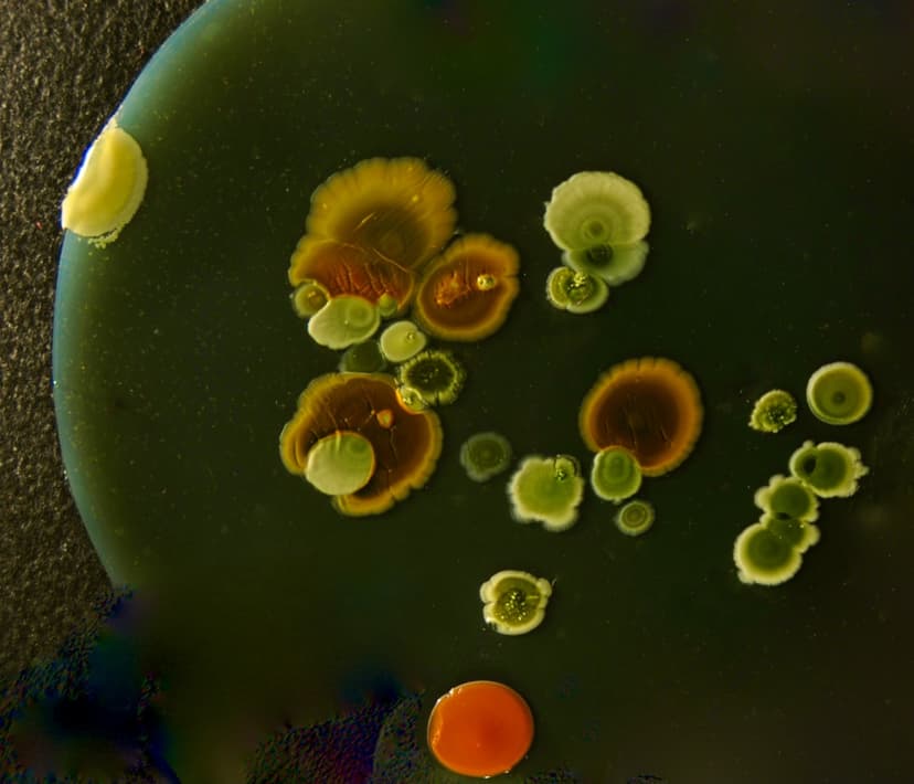Antibiotic Resistance: A Real Threat, Not Doom