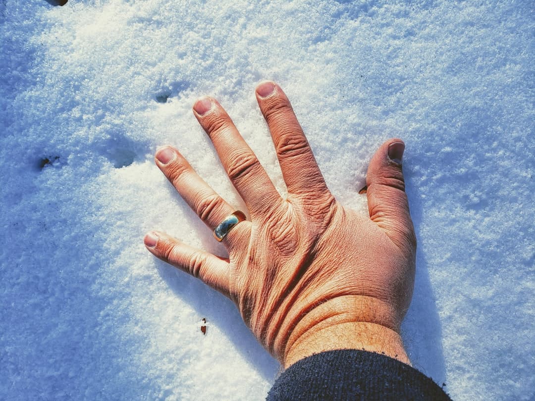 What it means if your hands are always cold